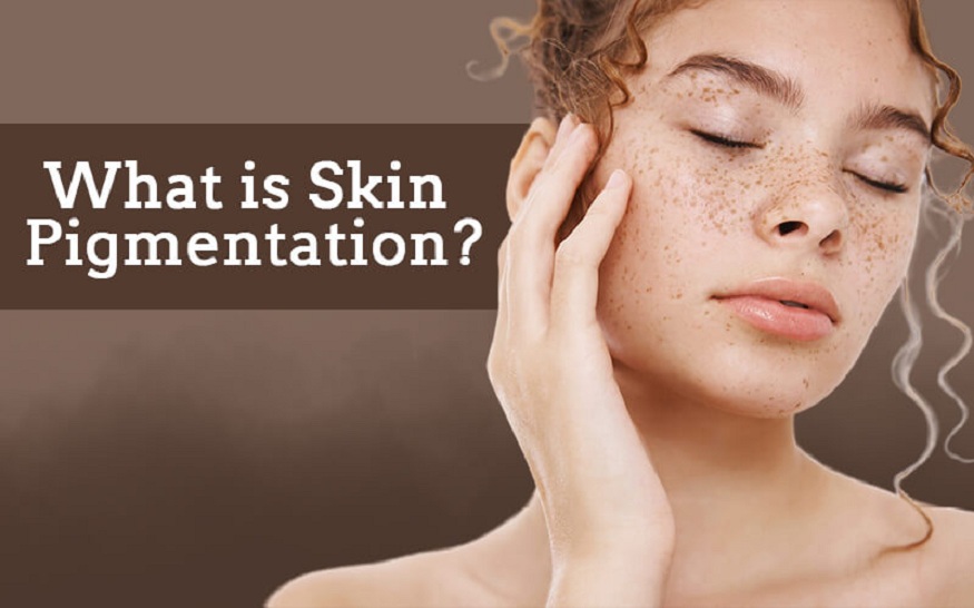 pigmentation creams